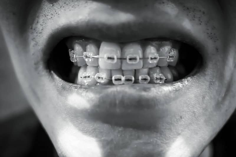 A black and white photo of a man's teeth