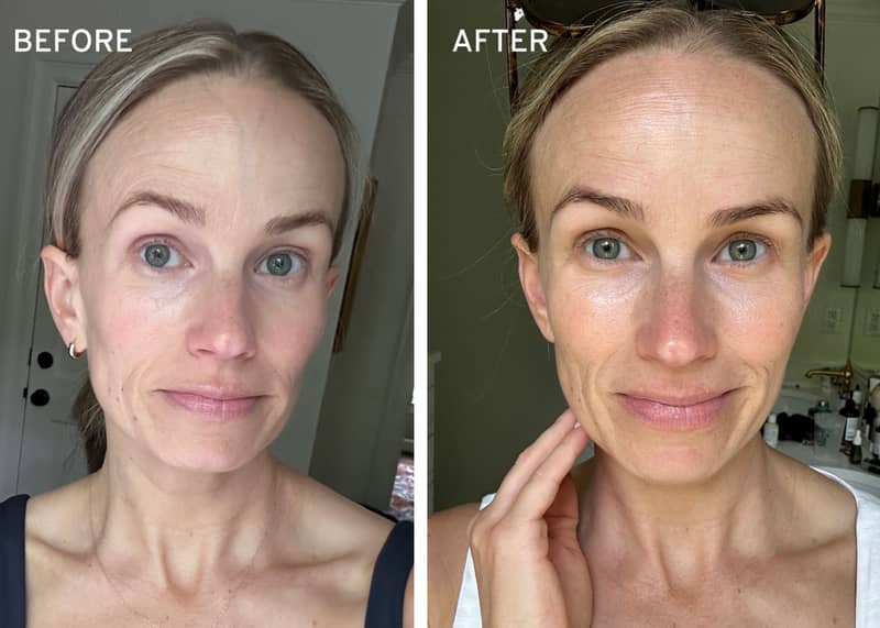 Oliveda F59 review with a before and after using the Botox in a Bottle serum