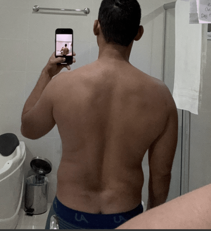 Pedro before, back
