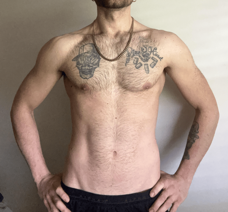 Dario after, front