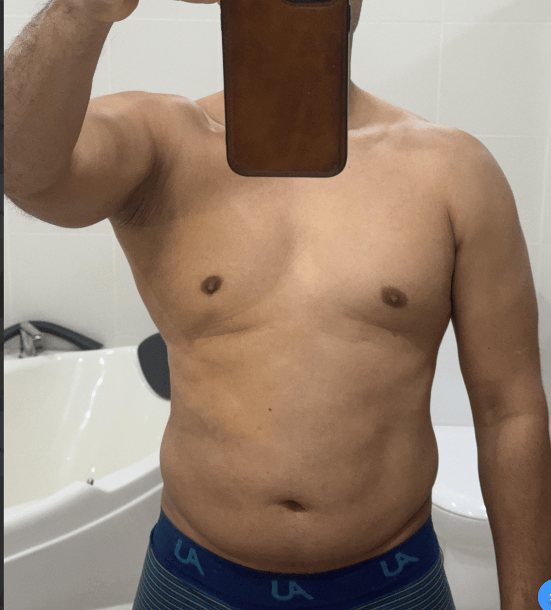 Pedro before, front