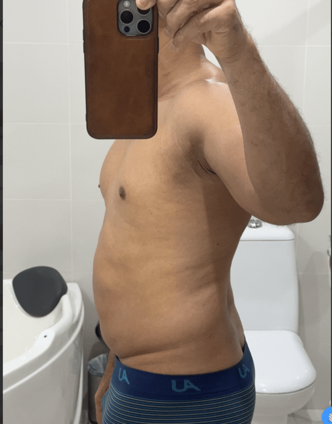 Pedro before, side