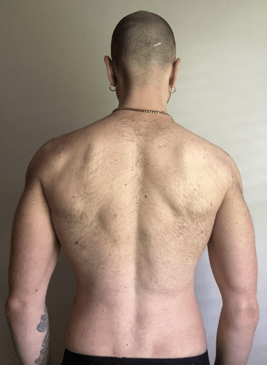 Dario after, back