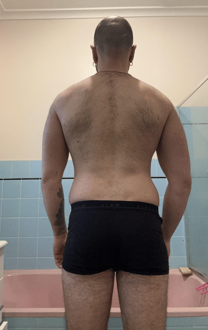Dario before, back