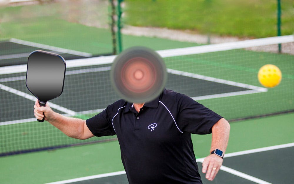 Murmurs from the Losers’ Bracket: A Former Pickleball Addict Speaks Out | Pickler Pickleball