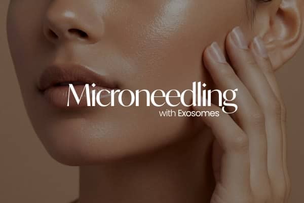 Microneedling Enhanced with Exosomes