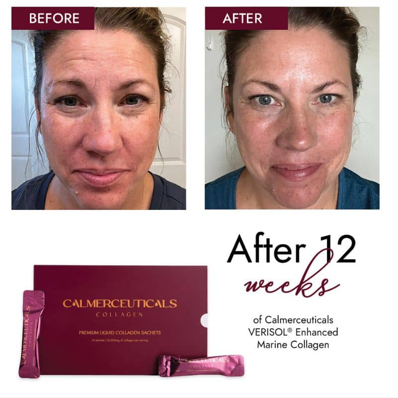 Calmerceuticals marine collagen