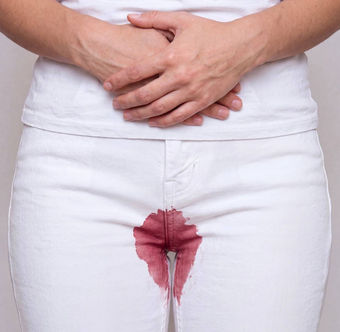 Sangrado en la perimenopausia