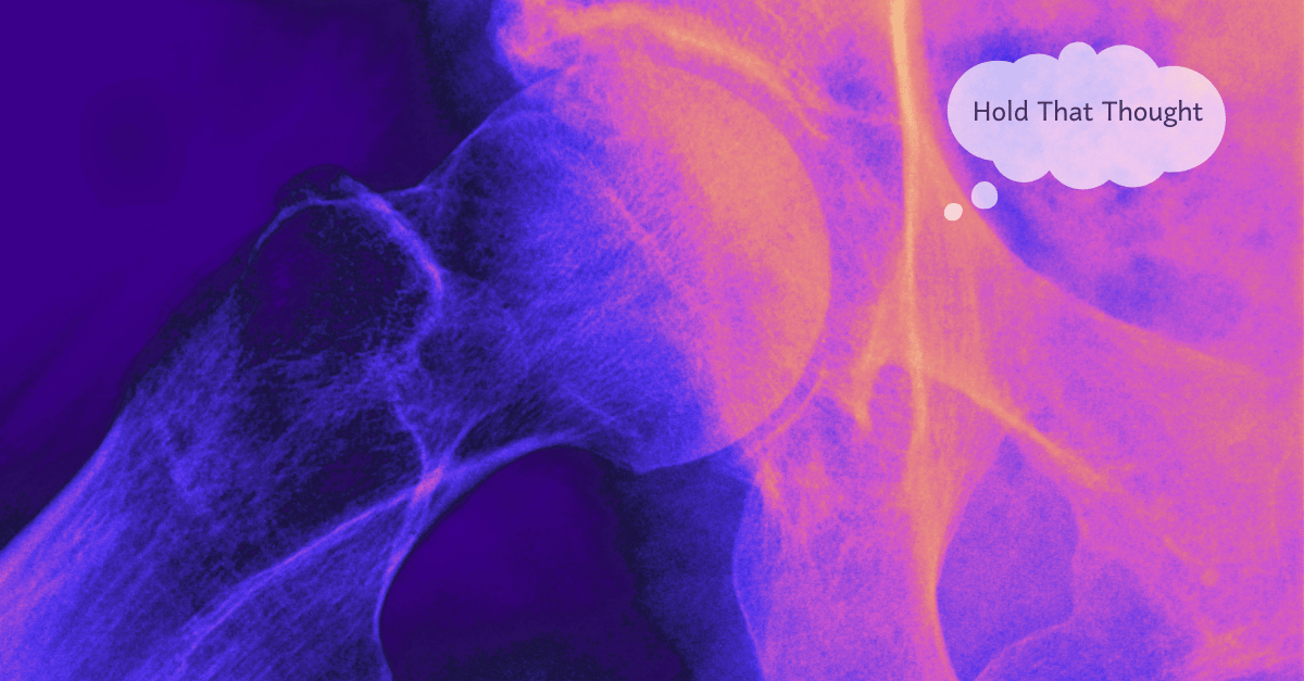 Close-up of hip joint showing the femoral head in the hip socket. A neon pink-blue filter is applied to the x-ray image.