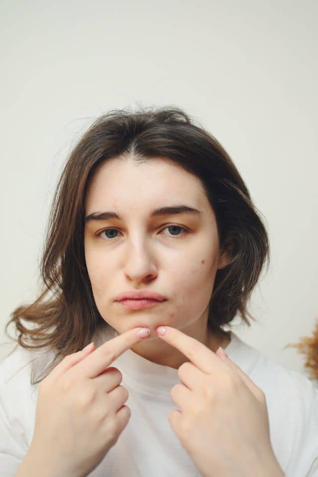 Woman popping a pimple