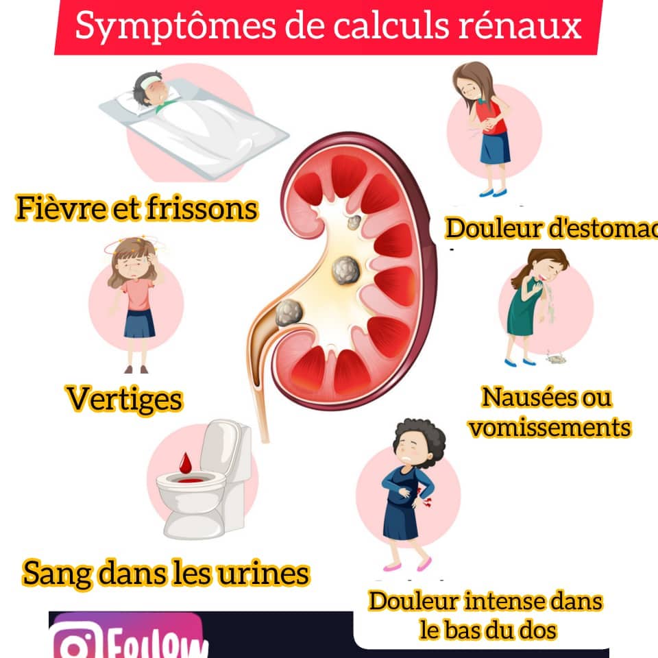 Remède naturel pour les problèmes des reins