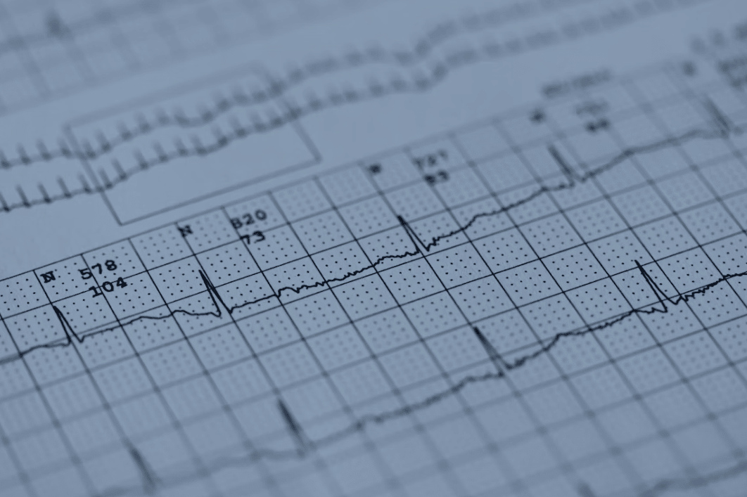 graph showing heart rate