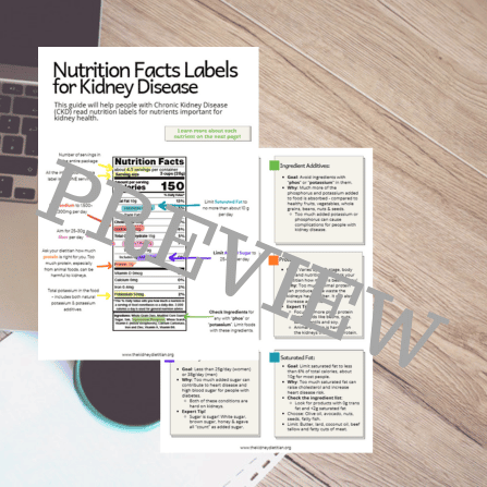 RD2RD CKD Label Reading (300 x 300 px)