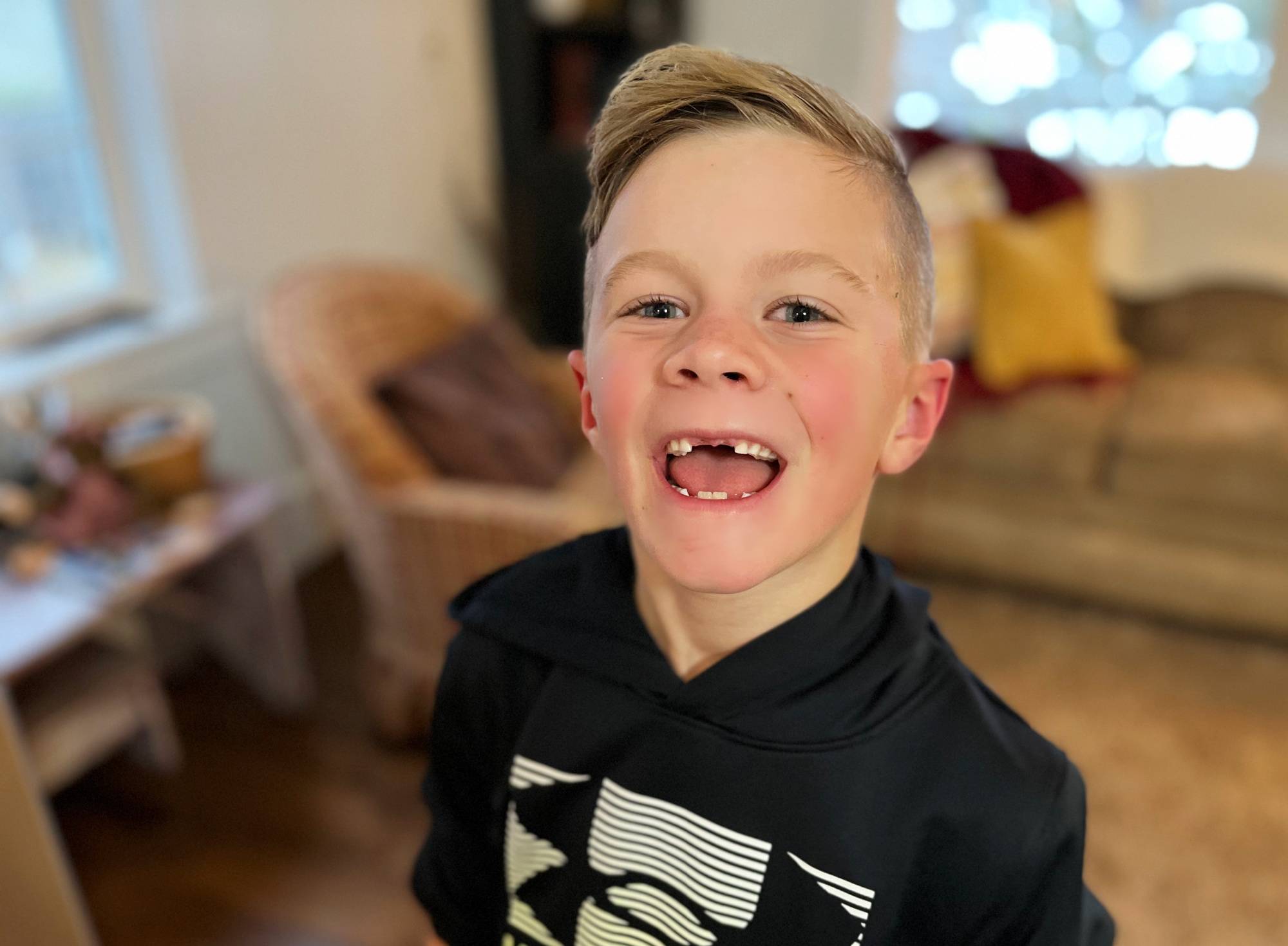 missing front teeth