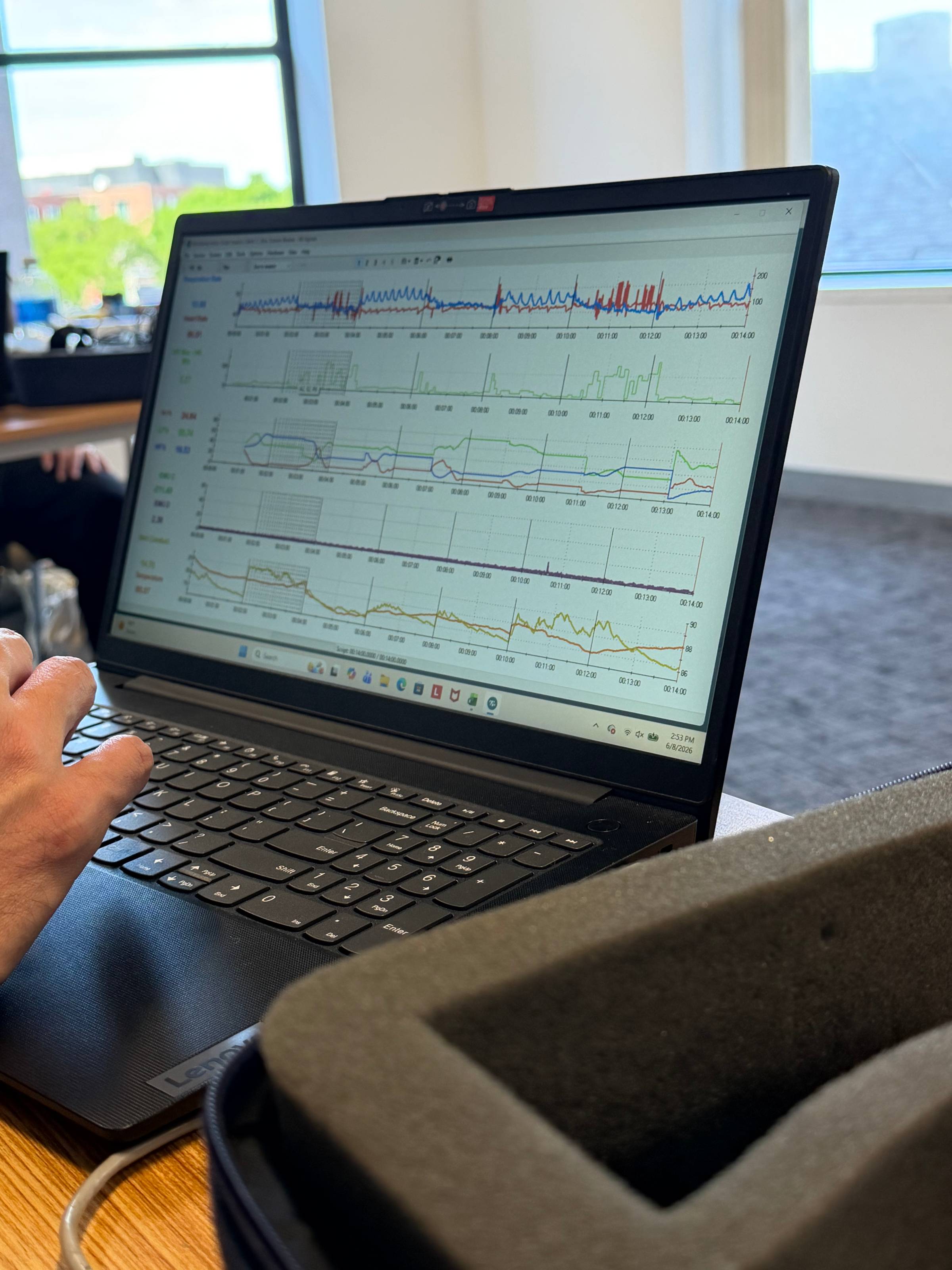 laptop showing HRV data
