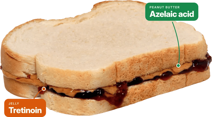 Peanut butter and jelly sandwich: azelaic acid is the peanut butter, tretinoin is the jelly