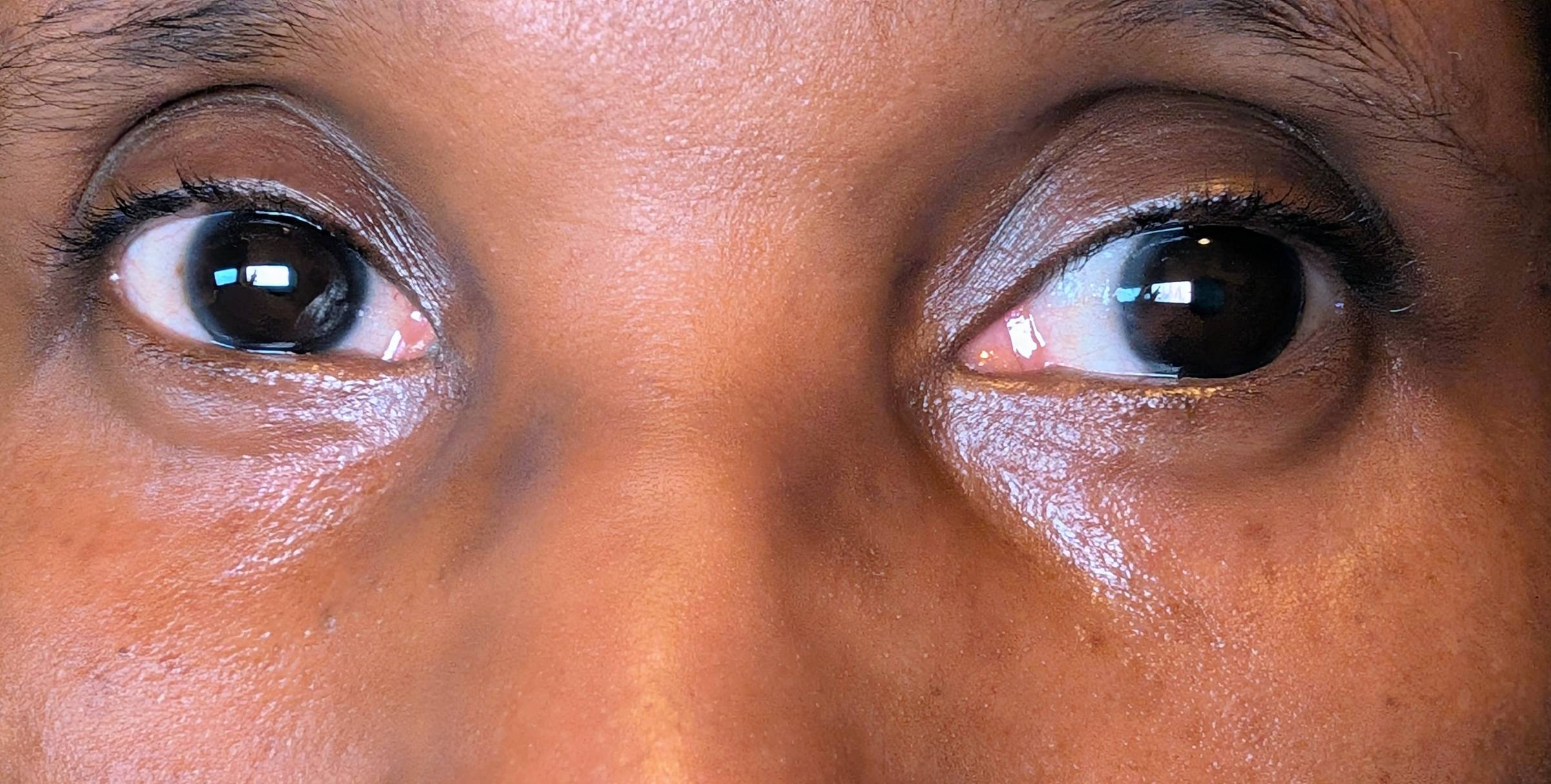 A close-up photograph of a woman’s eyes looking directly at the camera, with soft natural light highlighting the skin and lashes, symbolizing hidden discomfort and the experience of carrying something silently.