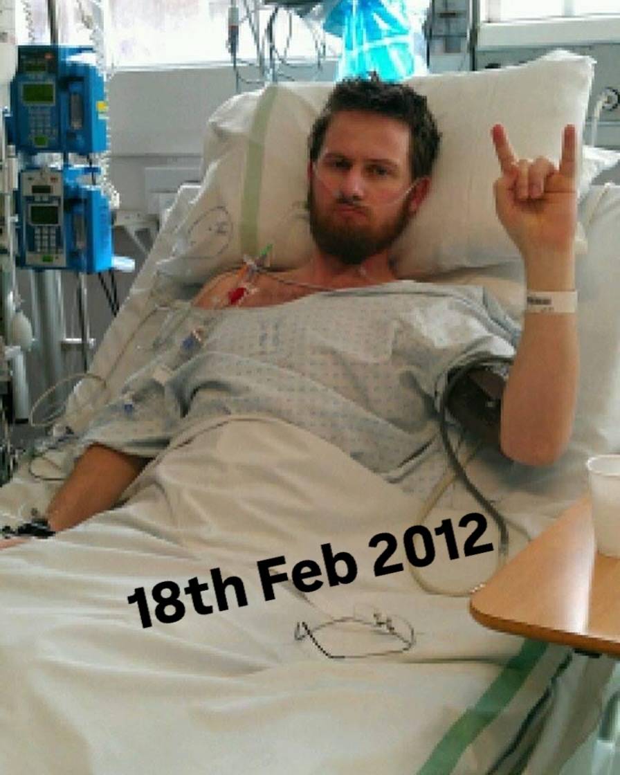 18th Feb 2012. Emergency Subtotal colectomy. #ulcerativecolitis #stoma #nocolonstillrollin #ibd #neardeathexperience