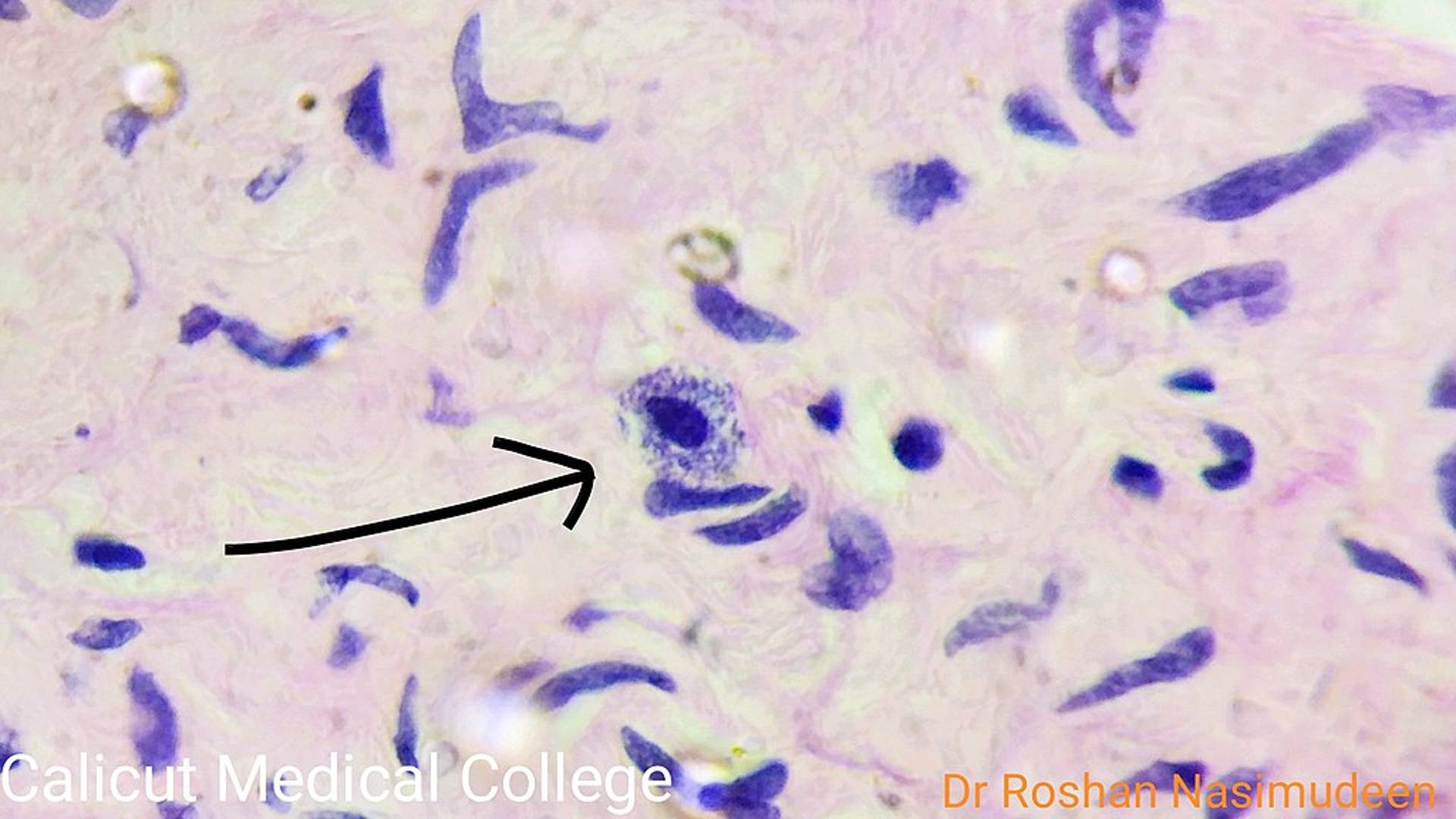 Mast cell