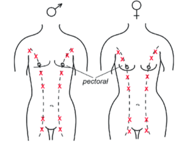 diagram showing where milk/mammary ridges form along the male and female human bodies
