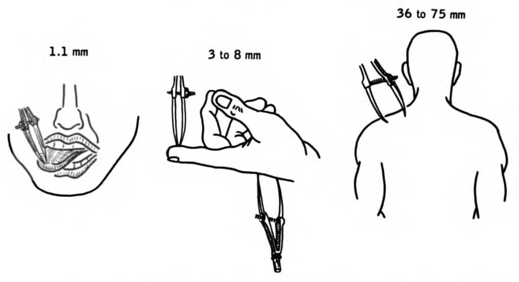 Diagram showing the two-point discrimination test performed on the tongue, finger, and shoulder.