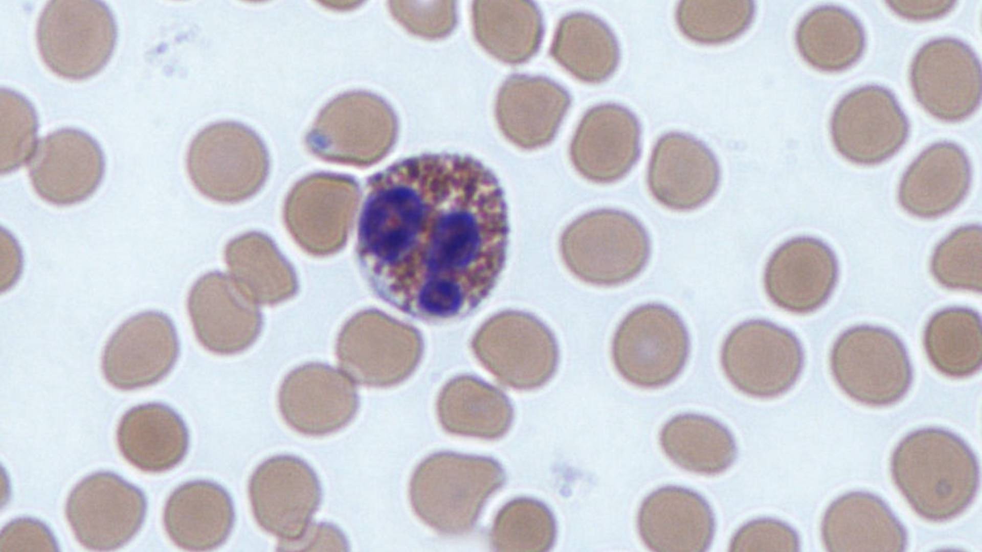 Eosinophil