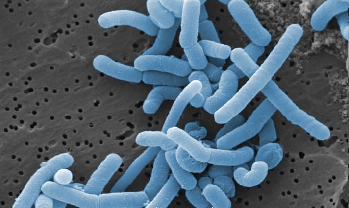  Colorized scanning electron micrographs of Lactobacillus paracasei