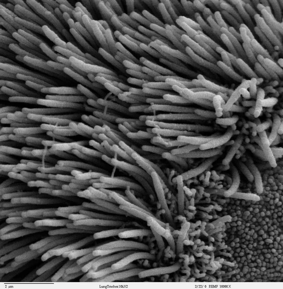 close-up image of cilia