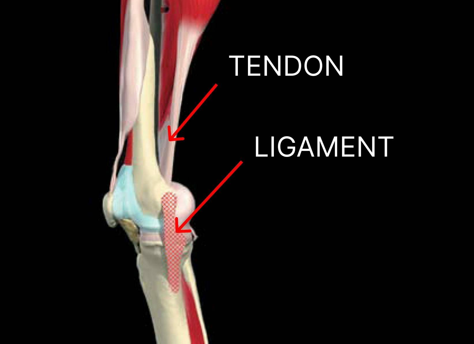 The image is an anatomical diagram of a human knee joint showing the relationship between a tendon and a ligament. The tendon, labeled in the upper part of the image, connects the muscle to the bone, appearing as a white, fibrous structure extending down from the muscle. The ligament, labeled below the tendon, is shown as a checkered pattern structure connecting two bones in the knee joint, providing stability. The surrounding bones, muscles, and joint structures are visible, illustrating how tendons and ligaments function within the knee. The background is black, and red arrows point to the tendon and ligament labels.