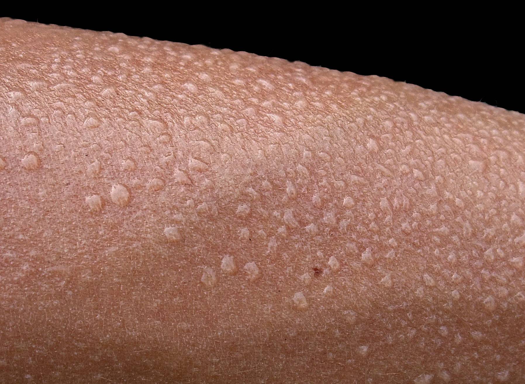 Close up of someone's skin with beads of sweat 