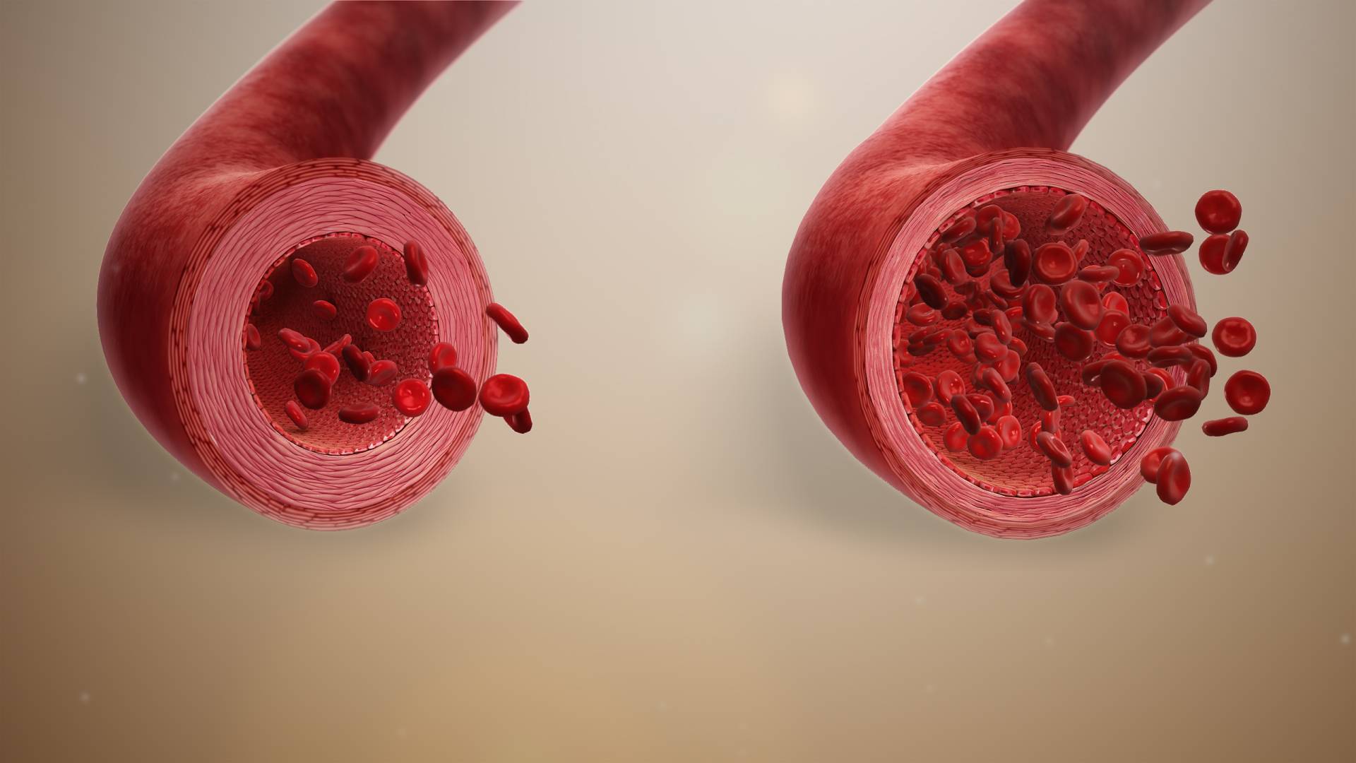 3D illustration of a blood vessel dilating.