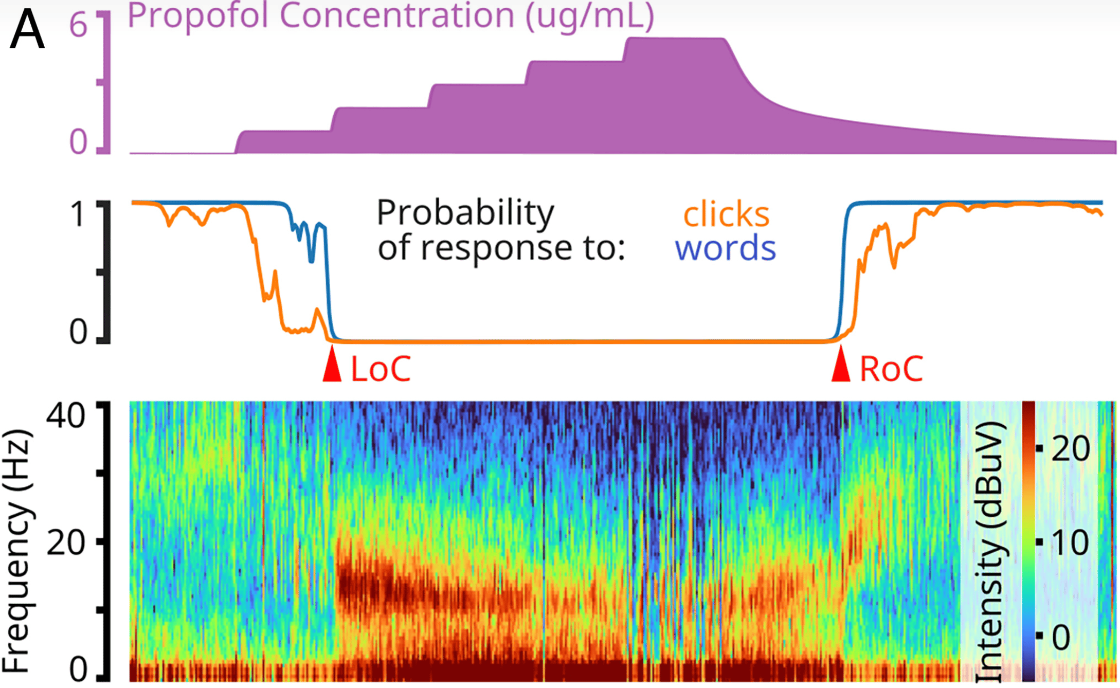 From top to bottom: These diagrams show how, as the patient receives more anesthesia (propofol) and they lose consciousness (LoC = loss of consciousness), their higher frequency brain waves (40Hz) become quieter.