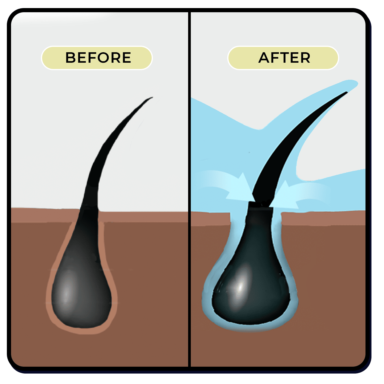 a side-by-side illustration showing a hair follicle before and after it gets hydrated