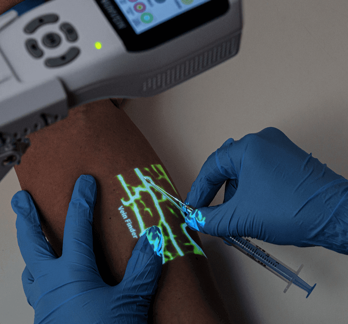 AimVein® Pro 3.0 Vein Finder for Clinical & Aesthetic Use – Aimvein
