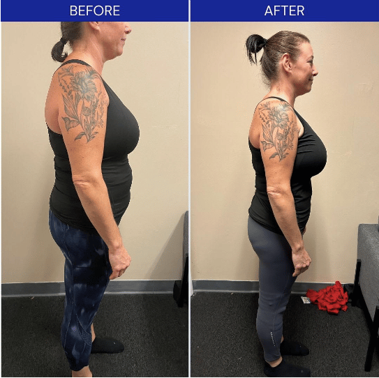 Before & After of eating nutritiously