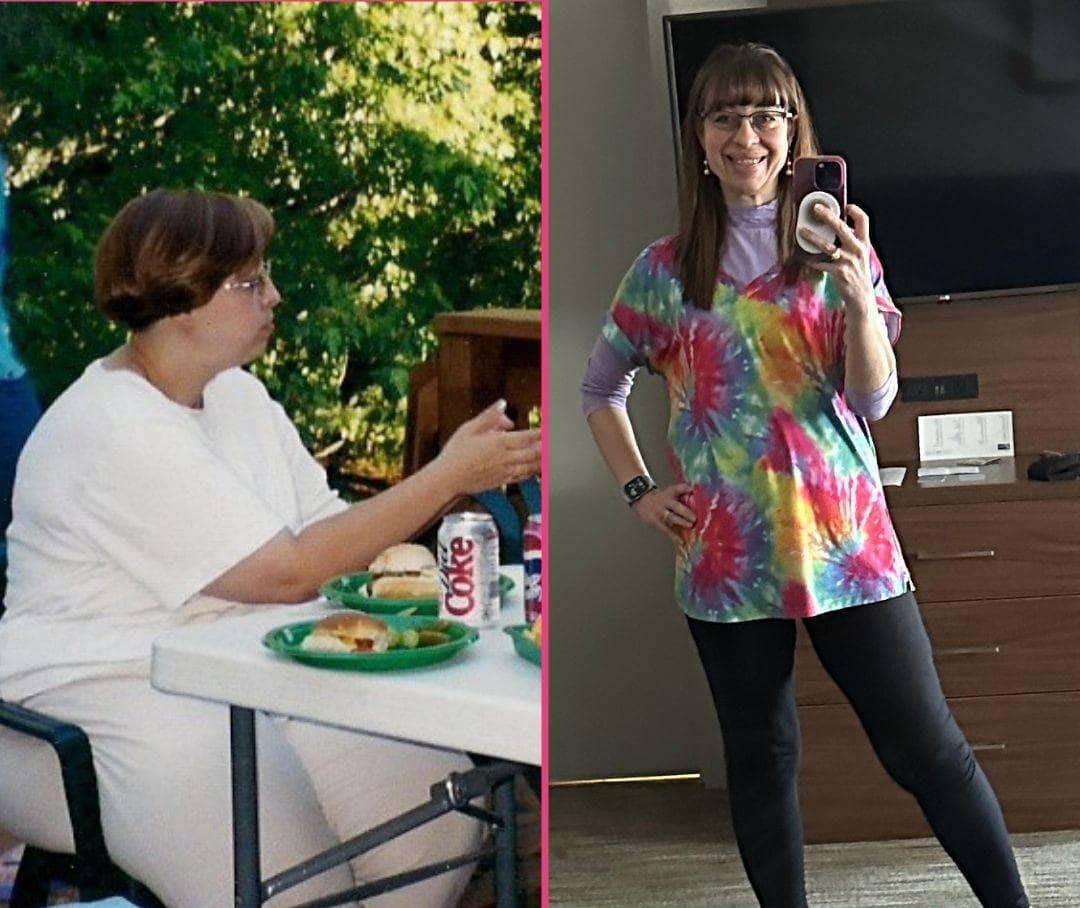Sara before after