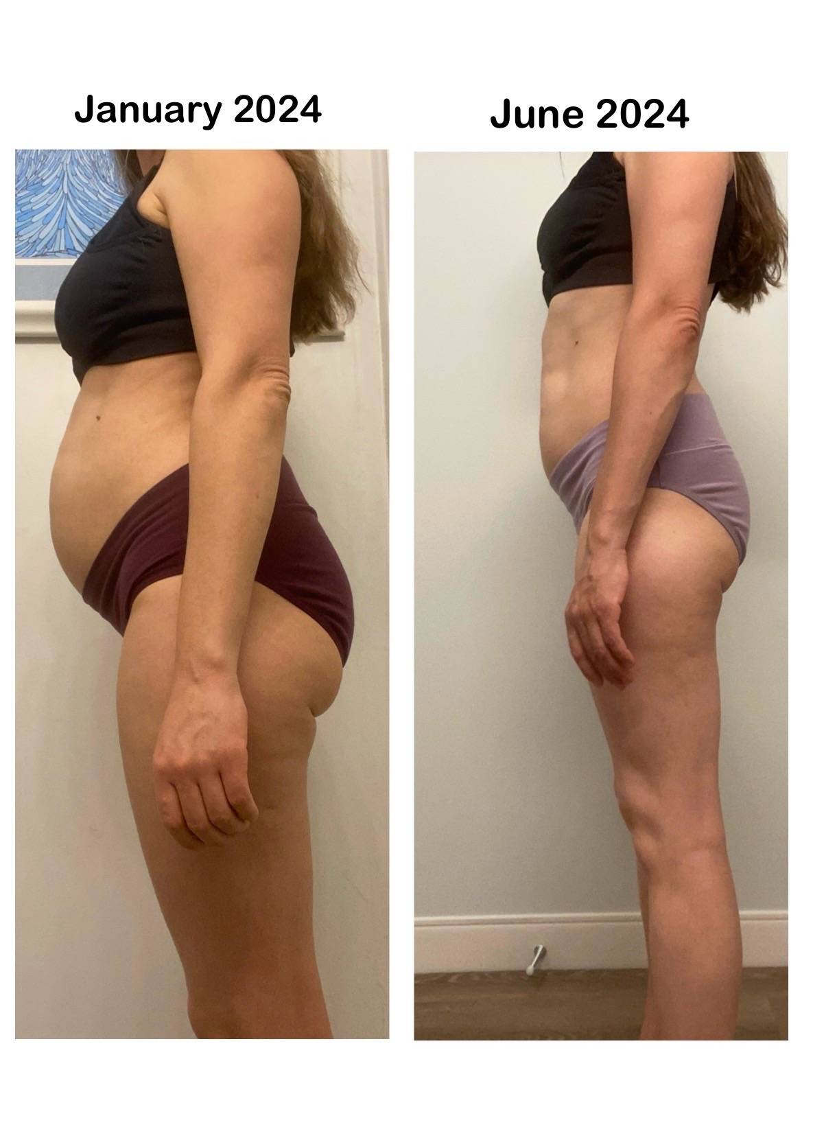 A side-by-side comparison image showing a woman's body transformation over six months. On the left, the woman is seen in January 2024 with a slightly protruded abdomen, wearing a black top and burgundy underwear. On the right, in June 2024, her abdomen ap