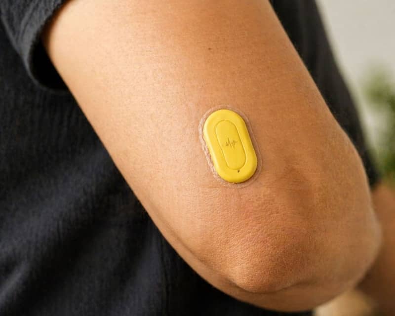 A yellow medical sensor attached to a person's arm.