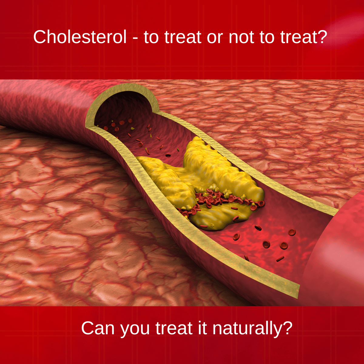 Cholesterol wars- can you win them naturally?