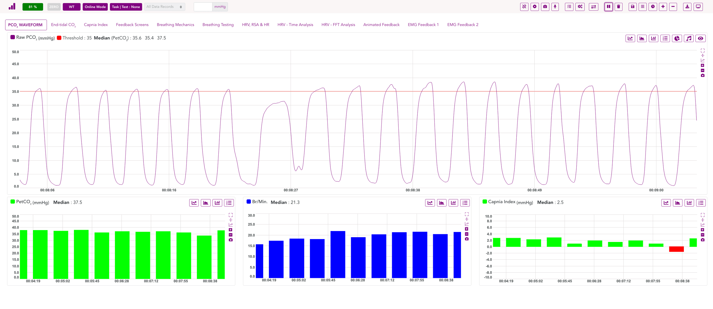 Waveform from capnometer software
