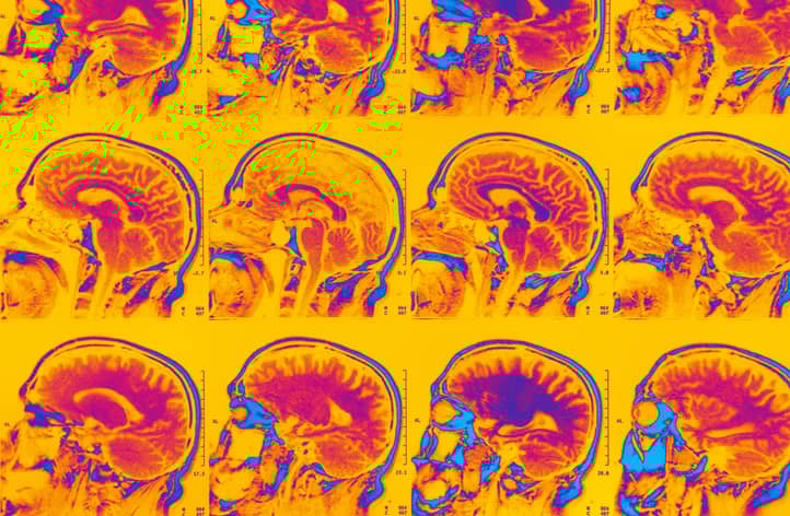 The Astonishing Growth Of The Human Brain A 300 Increase - fjm7pu5