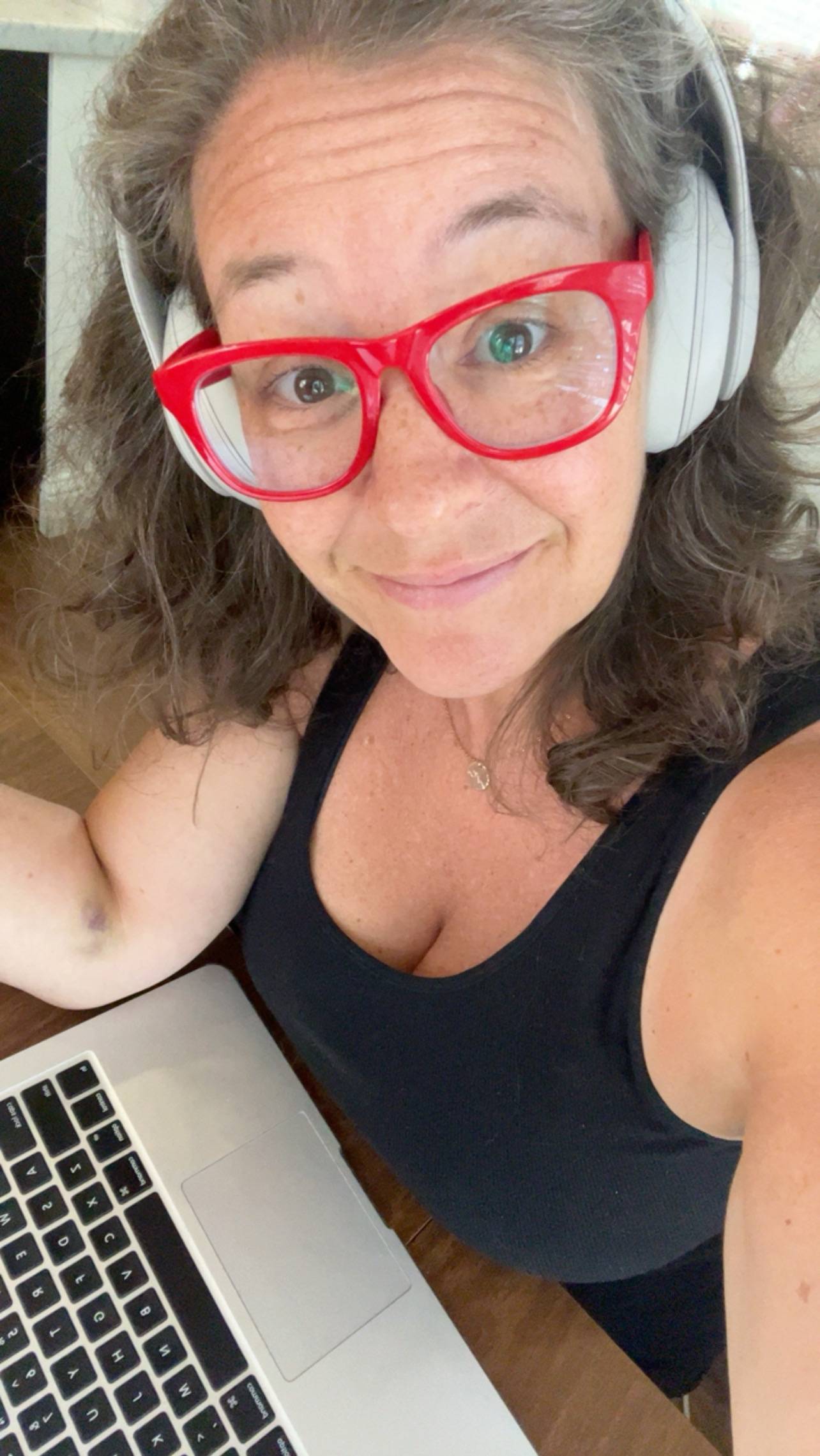 A woman wearing red glasses and head phones sitting in front of her computer; she's looking at the camera and smiling. Also visible is a large bruise on her elbow.