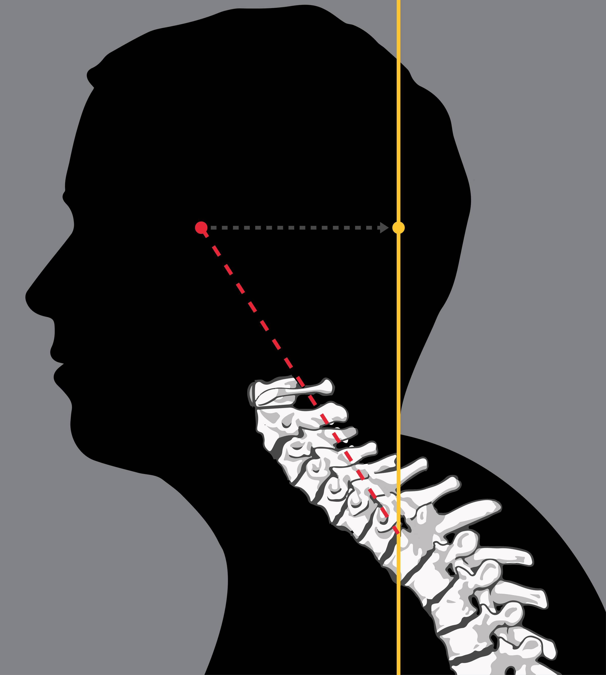 Ce Que La Mauvaise Posture De Votre Enfant Revele Sur Sa Sante Future Precision Chiropratique