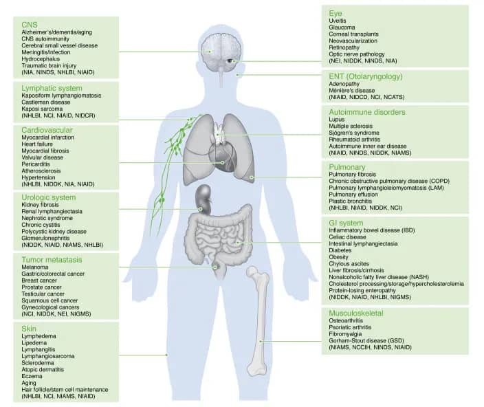 Visual map of lymphatic diseases and fluid-related disorders across the body.