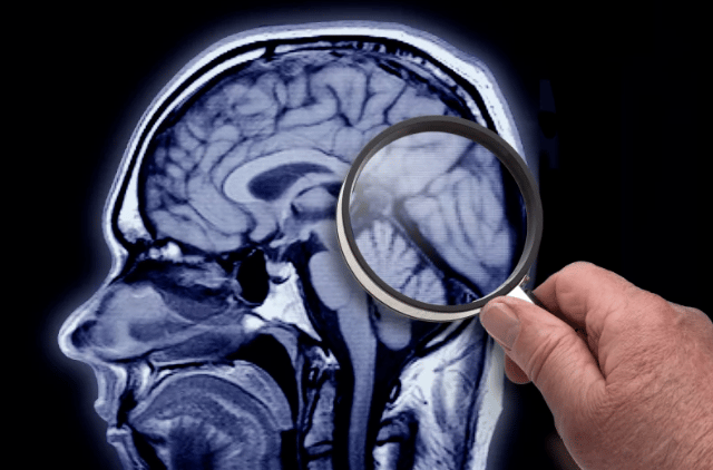 Various pieces of colorful trash, such as plastic bottle caps and plastics forks, are arranged in the shape of a human brain, on a light blue background.