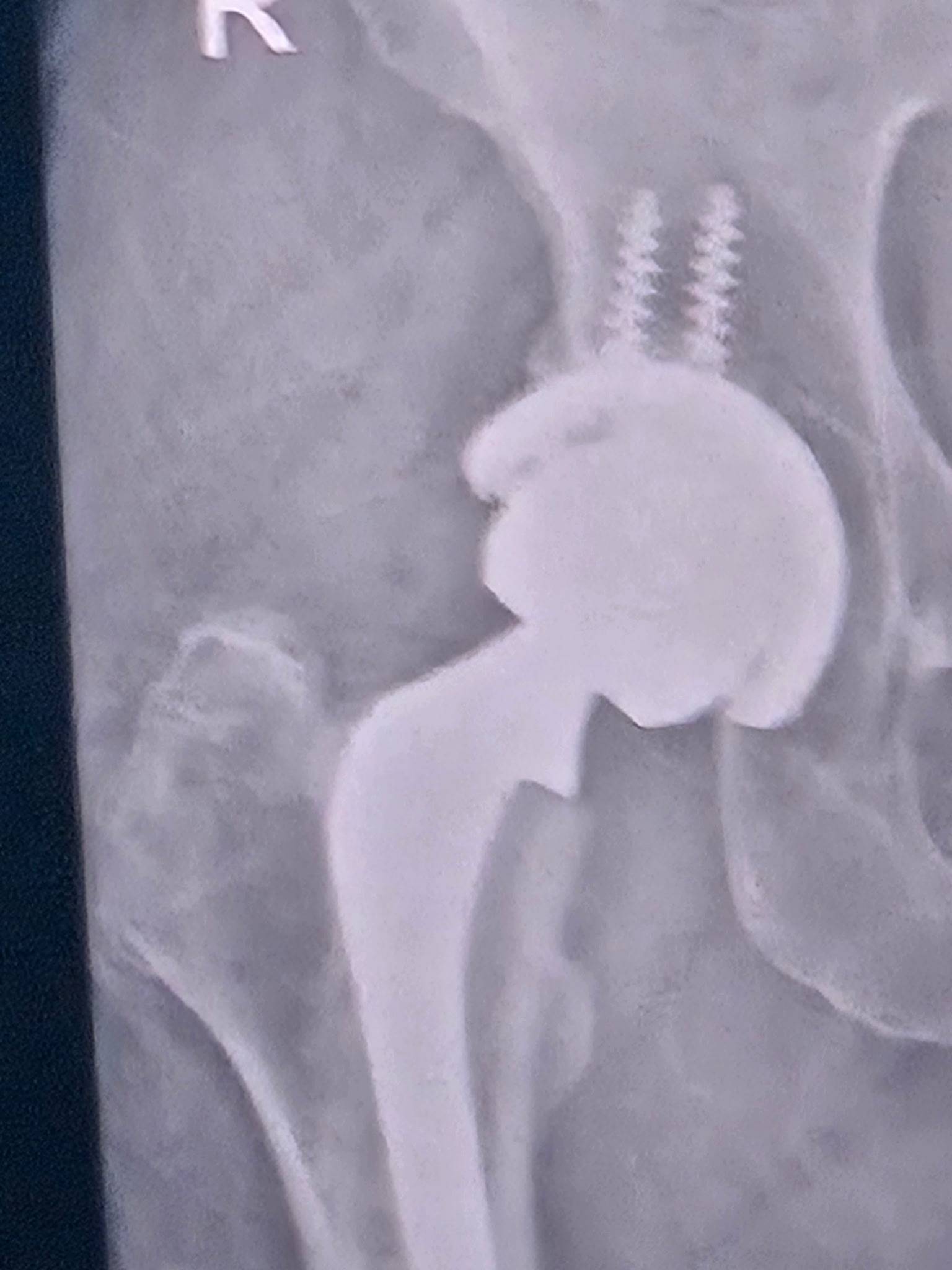 Who's the Boss of Your Recovery?