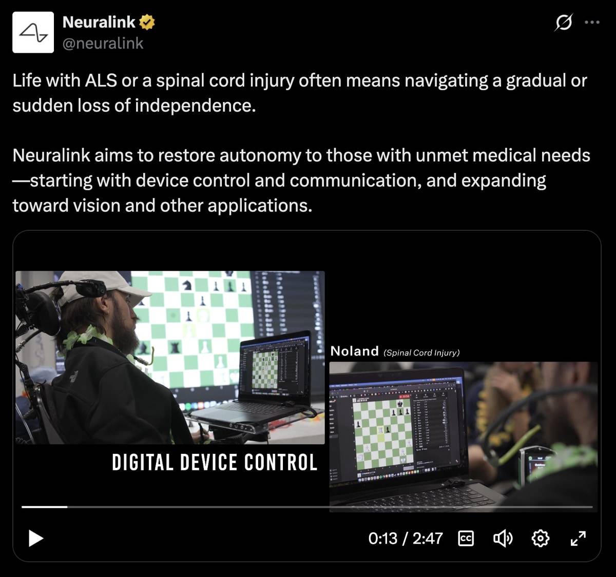 X post by @neuralink