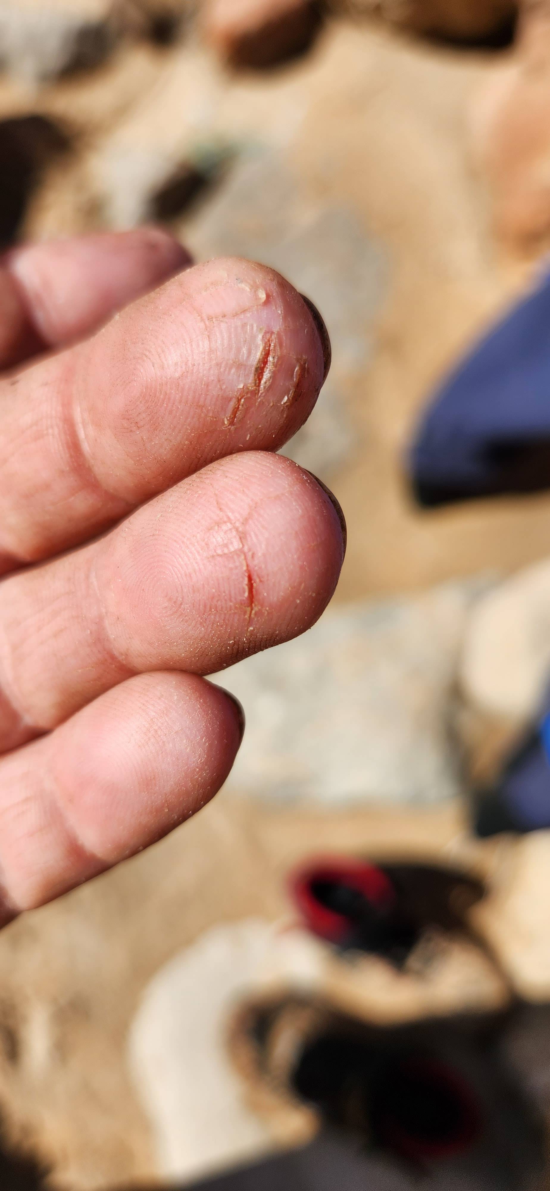 Cracked hands from a month of rowing.