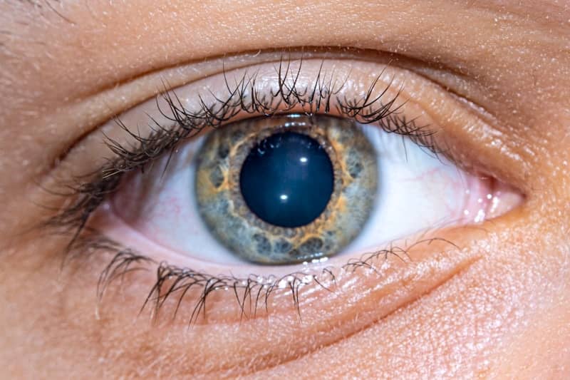 A human eye with a blue pupil and multicolored iris.