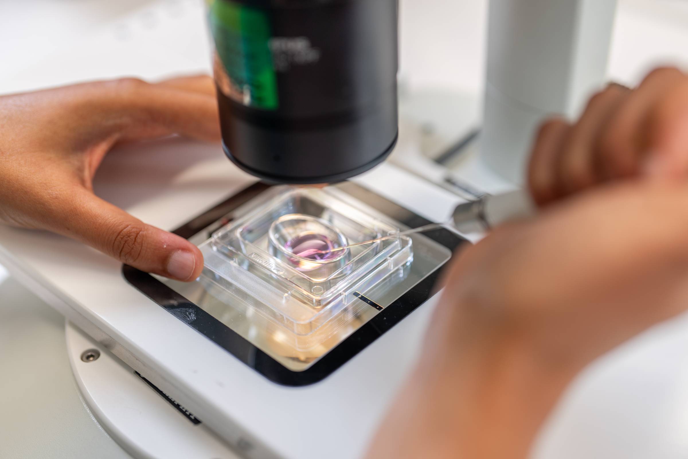 Close-up of hands holding a fine injection needle carefully injecting a single cell under a microscope, illustrating the delicate process of in vitro fertilization embryo transfer.